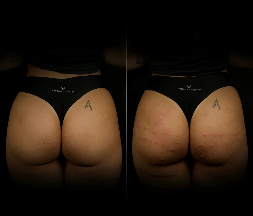 Imagem escolha de produtos