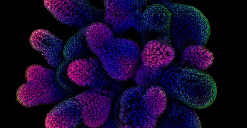 Fluorescence microscopy image of a lab-grown liver organoid