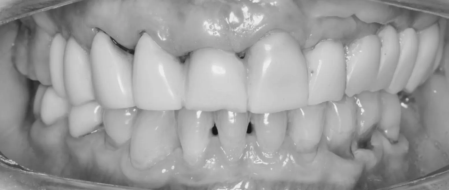 Examples of complex cases treated