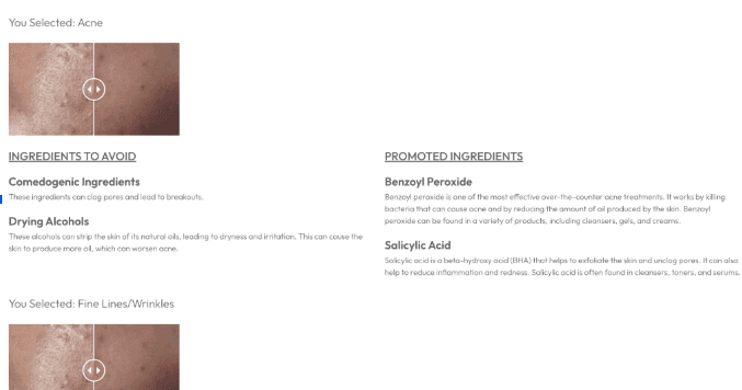 Survey results page showing unselected skin concerns