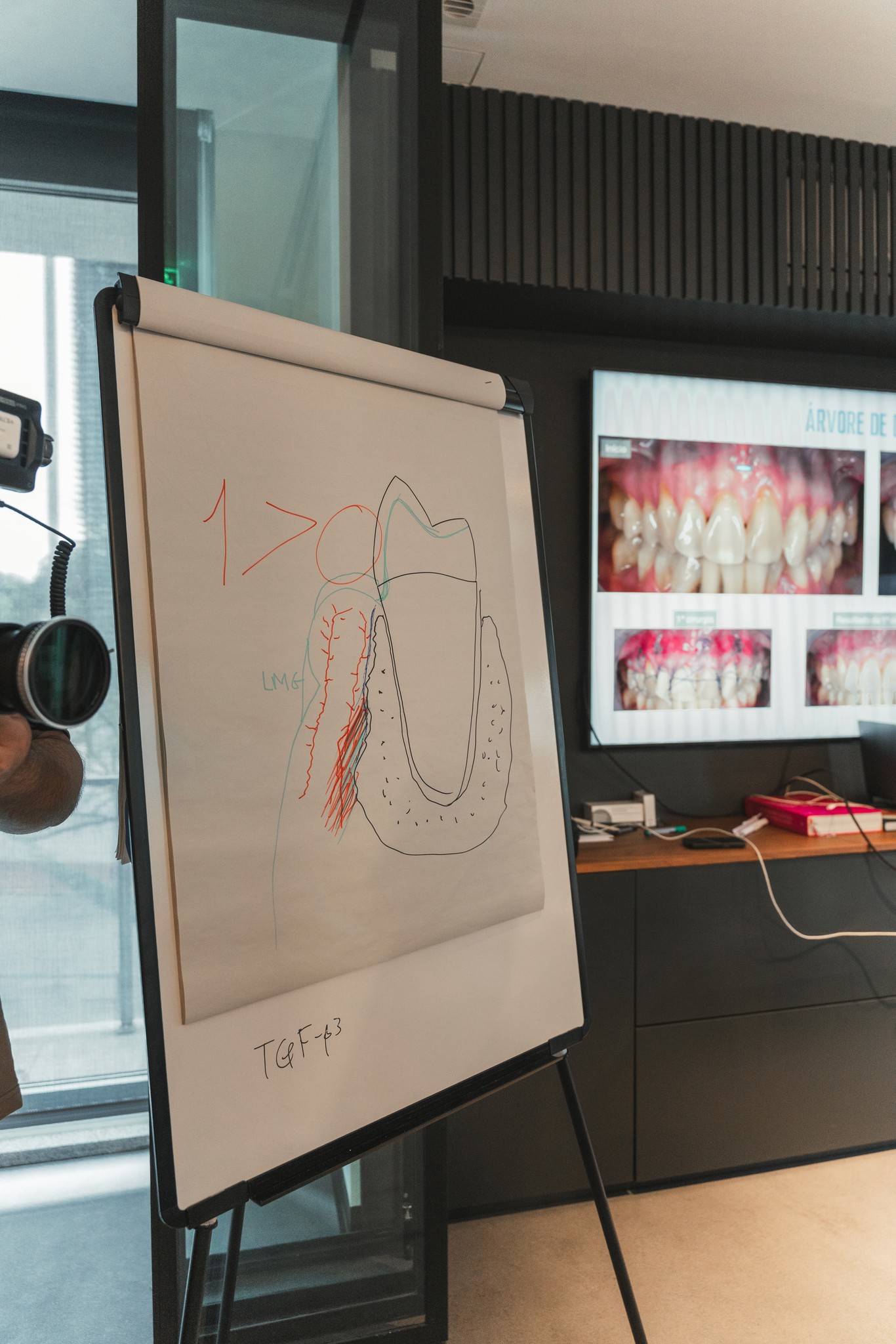 Comparação entre técnicas verticais e horizontais