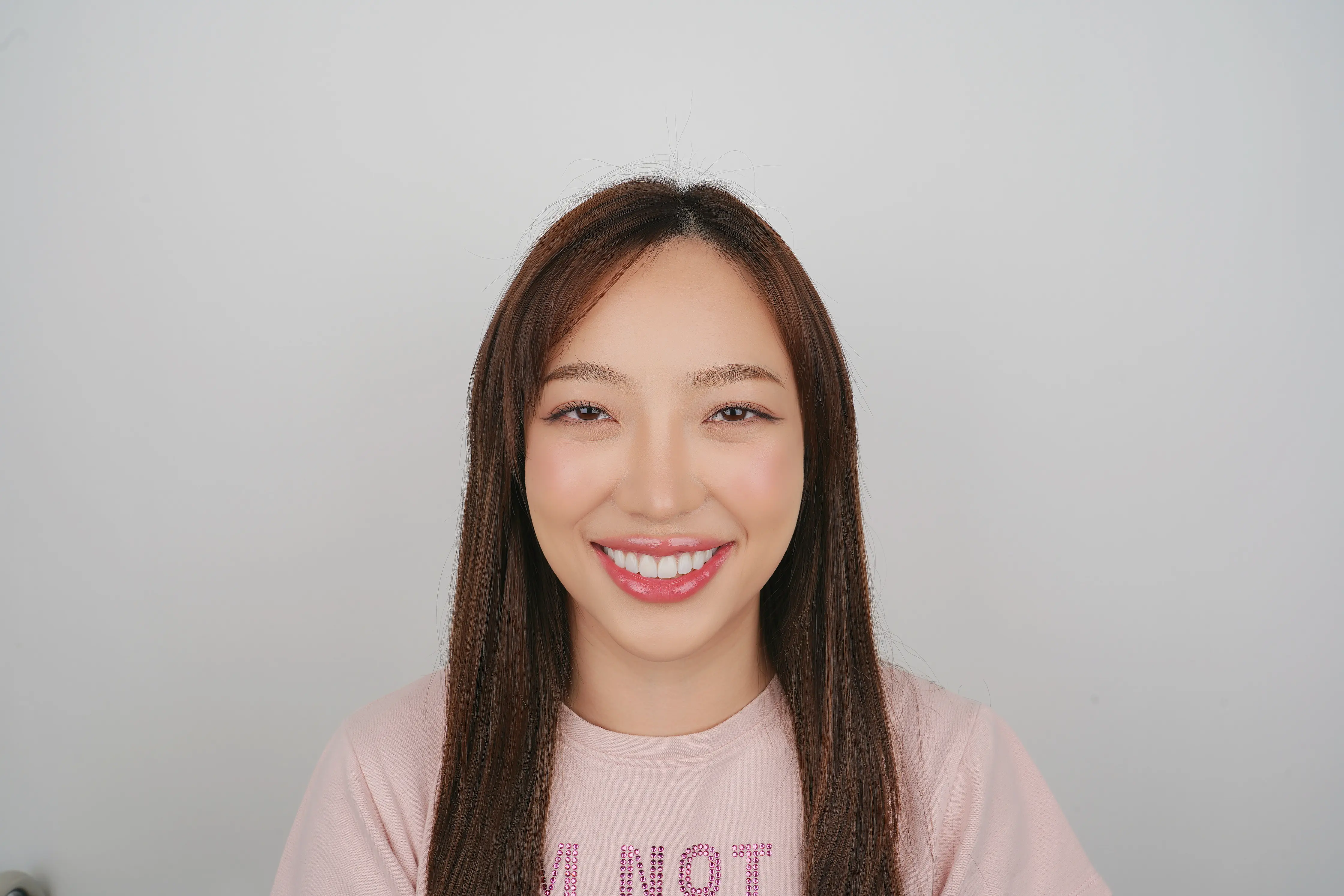 รีวิว-วีเนียร์-คุณซี-cosdent smile design