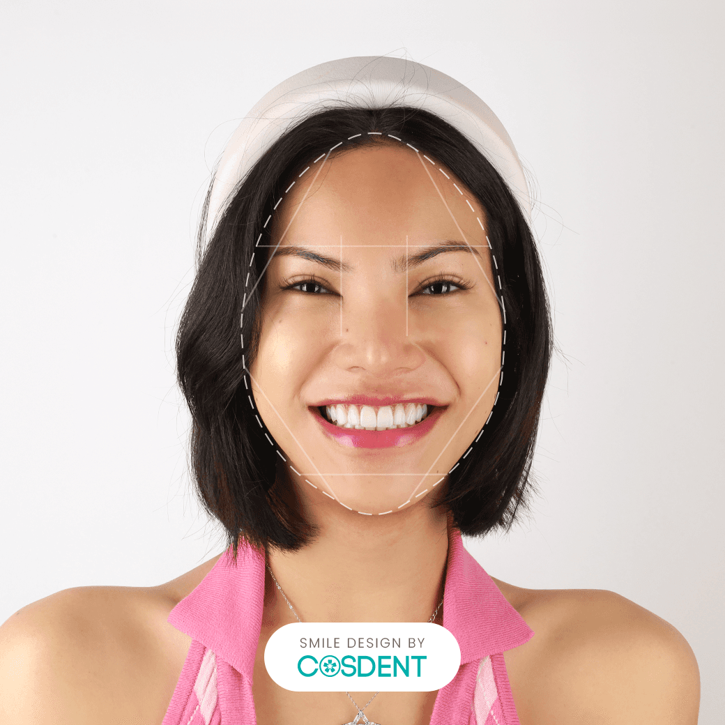 หน้าเพชร ยิ้มกว้าง 18 ซี่