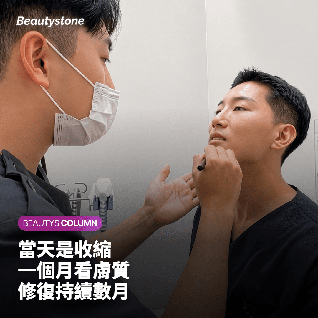 Oligio X 效果多久看得到？當天、一個月、幾個月後各看什麼