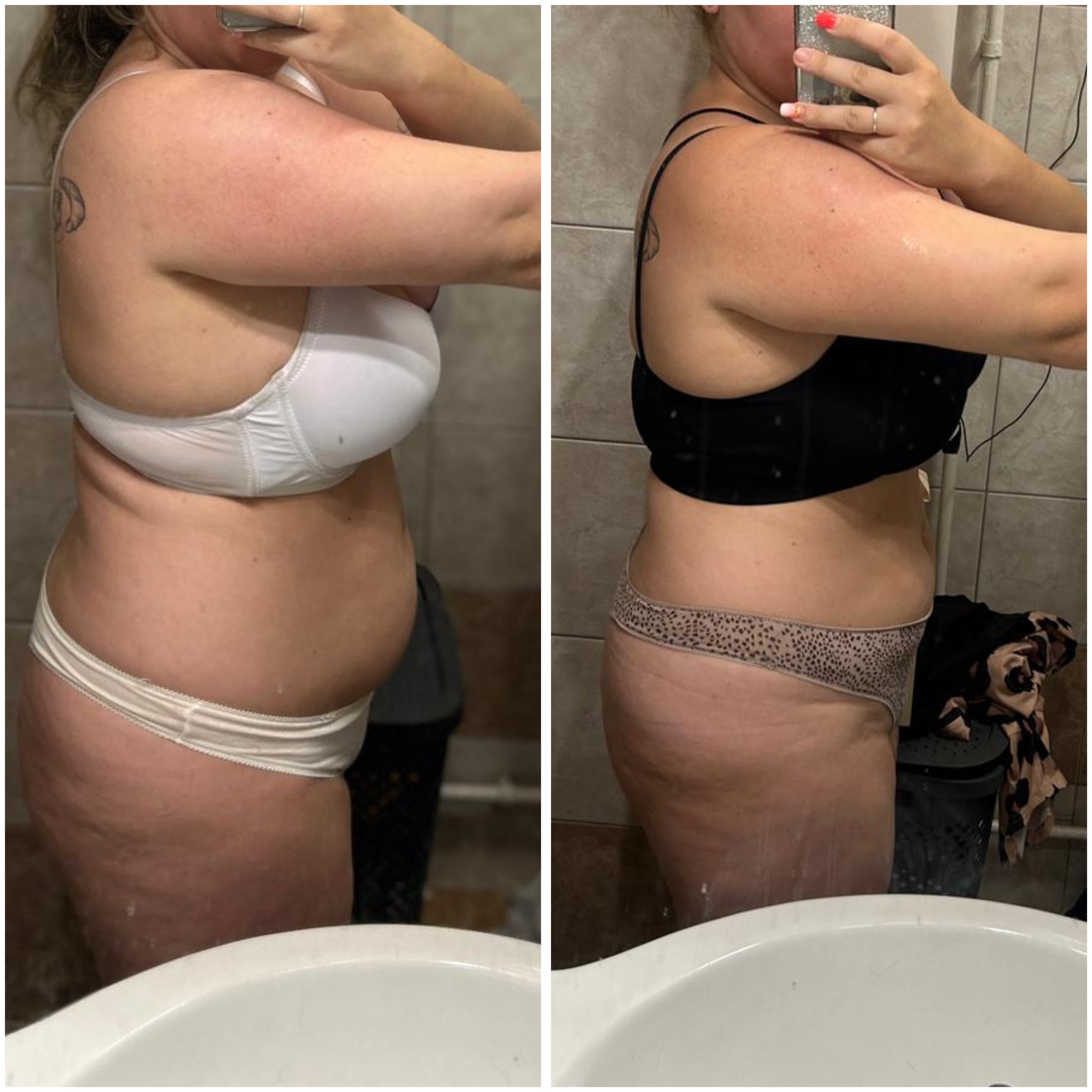 Transformation Photo