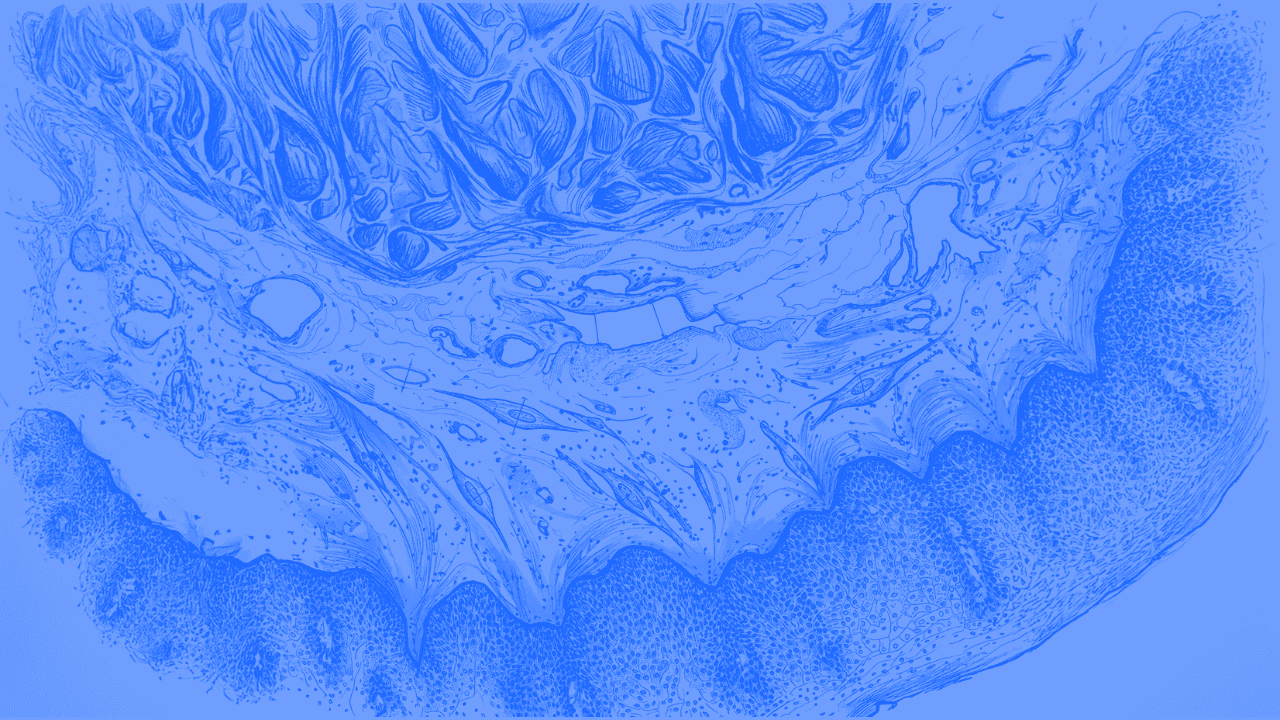 Scientific visualization of fibrosis as a therapeutic area for MDL-4102 BRD4 inhibition