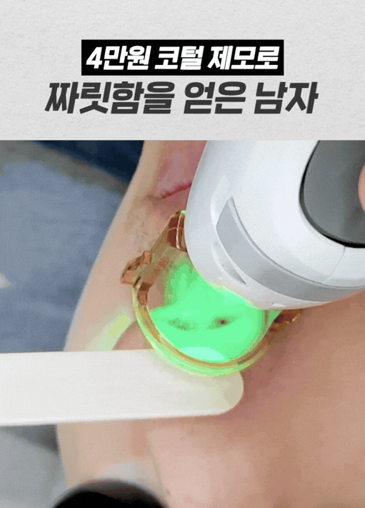 남자 얼굴 전체 제모 범위 안내   — 홍대 뷰티스톤의원