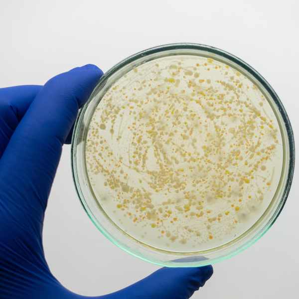 A hand wearing deep blue gloves holding a petri dish with a growing culture.