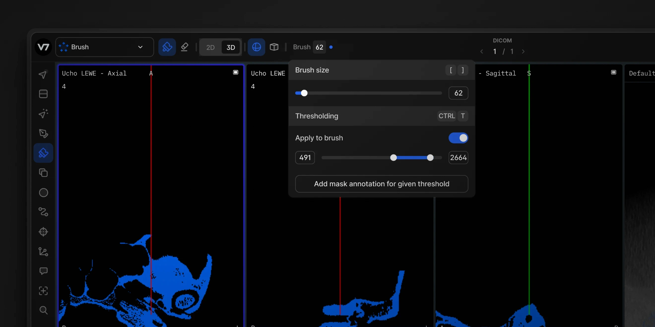 3D Thresholding Brush UI Updates