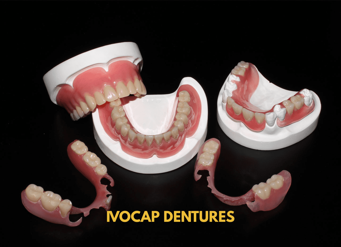 dental clinic davao matina crossing doctor showing sample of ivocap dentures