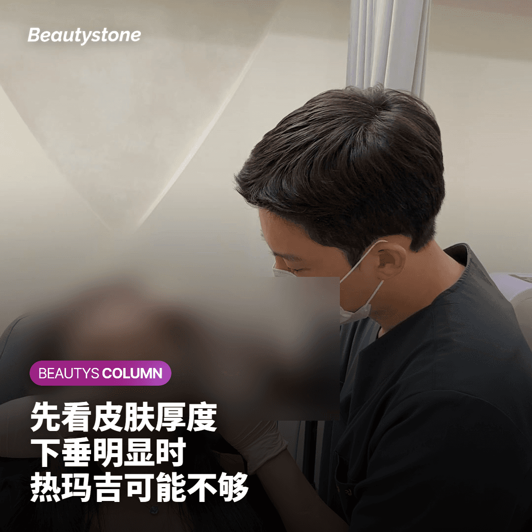 我的松弛适合热玛吉FLX吗？哪些情况效果有限