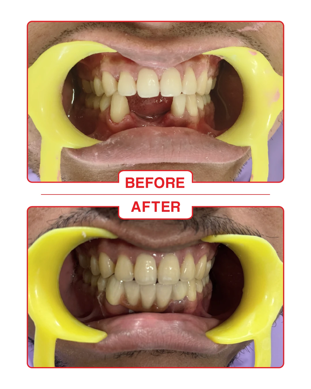 dental clinics goa