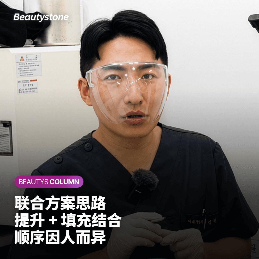 选择前可以自行参考的判断要点