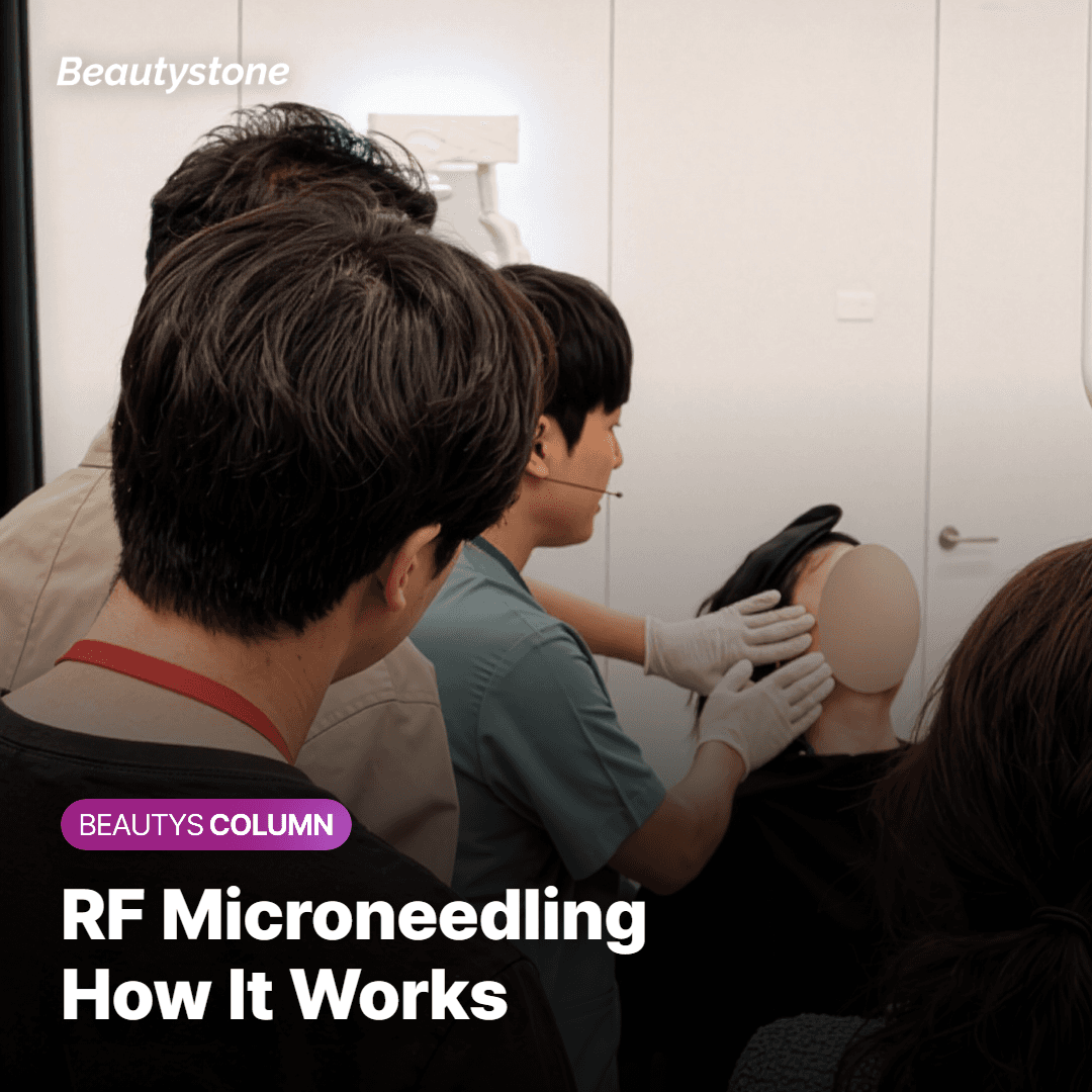 Illustration of treatable and off-limits zones around the eye for RF microneedling