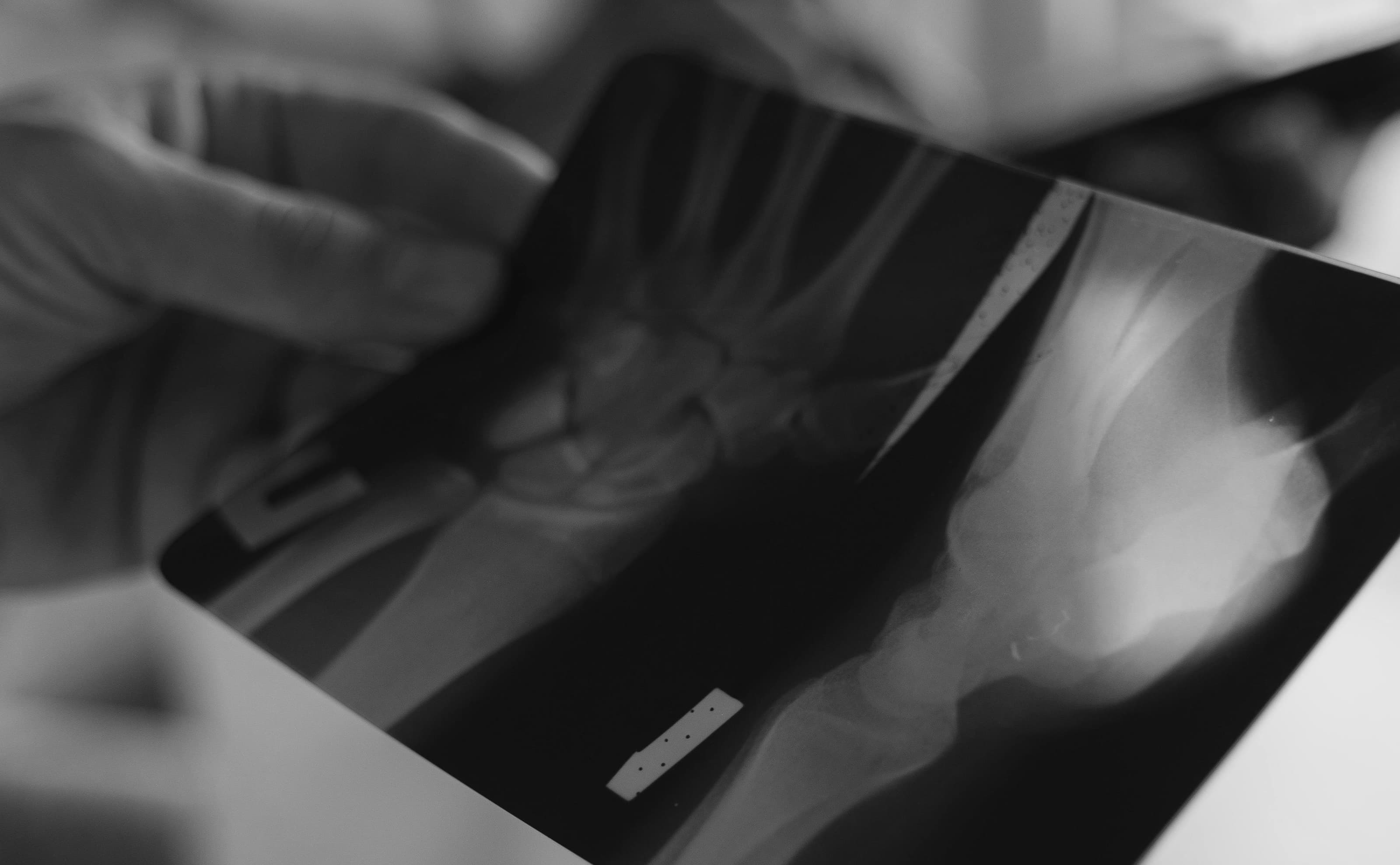 Analyse eines Röntgenbildes zur exakten Diagnoseerstellung in Zusammenarbeit mit Spezialisten und Ärzten.
