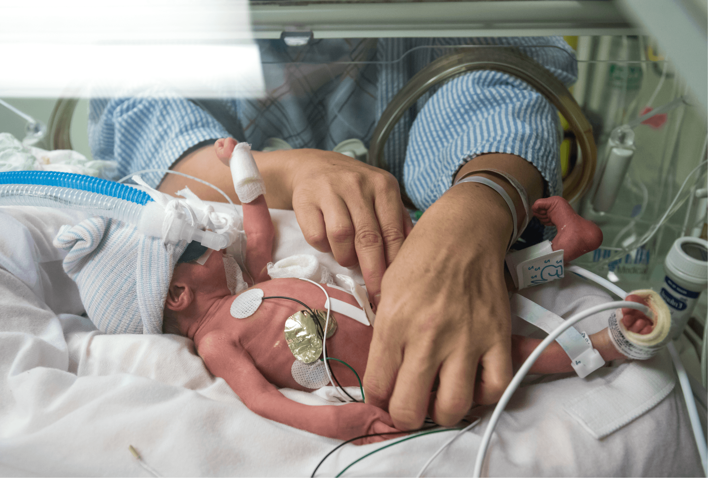 medical professional tending to a premature infant in a hospital incubator in the NICU