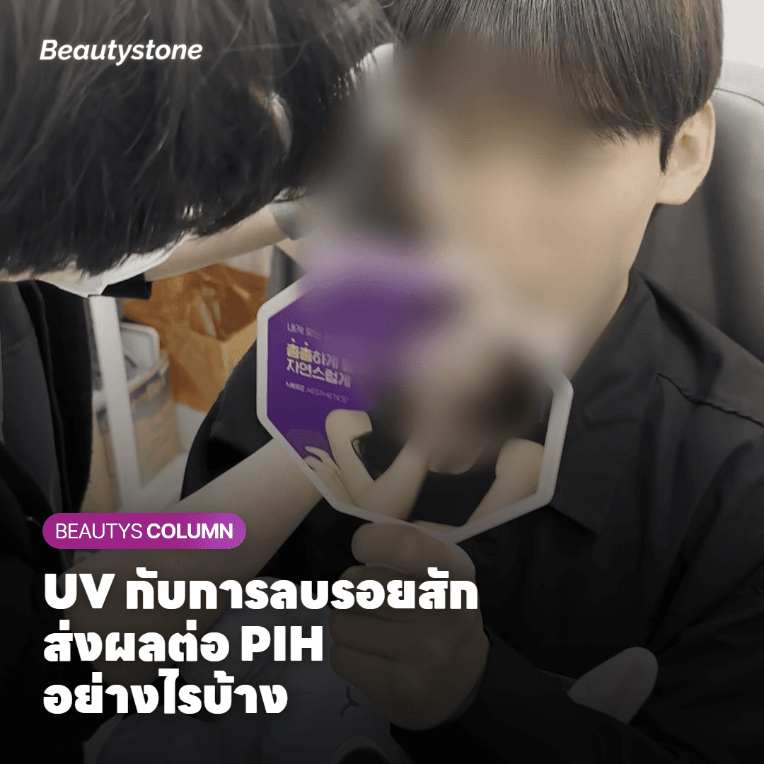UV ส่งผลต่อการฟื้นตัวระหว่างครั้งลบรอยสัก Pico Laser อย่างไร