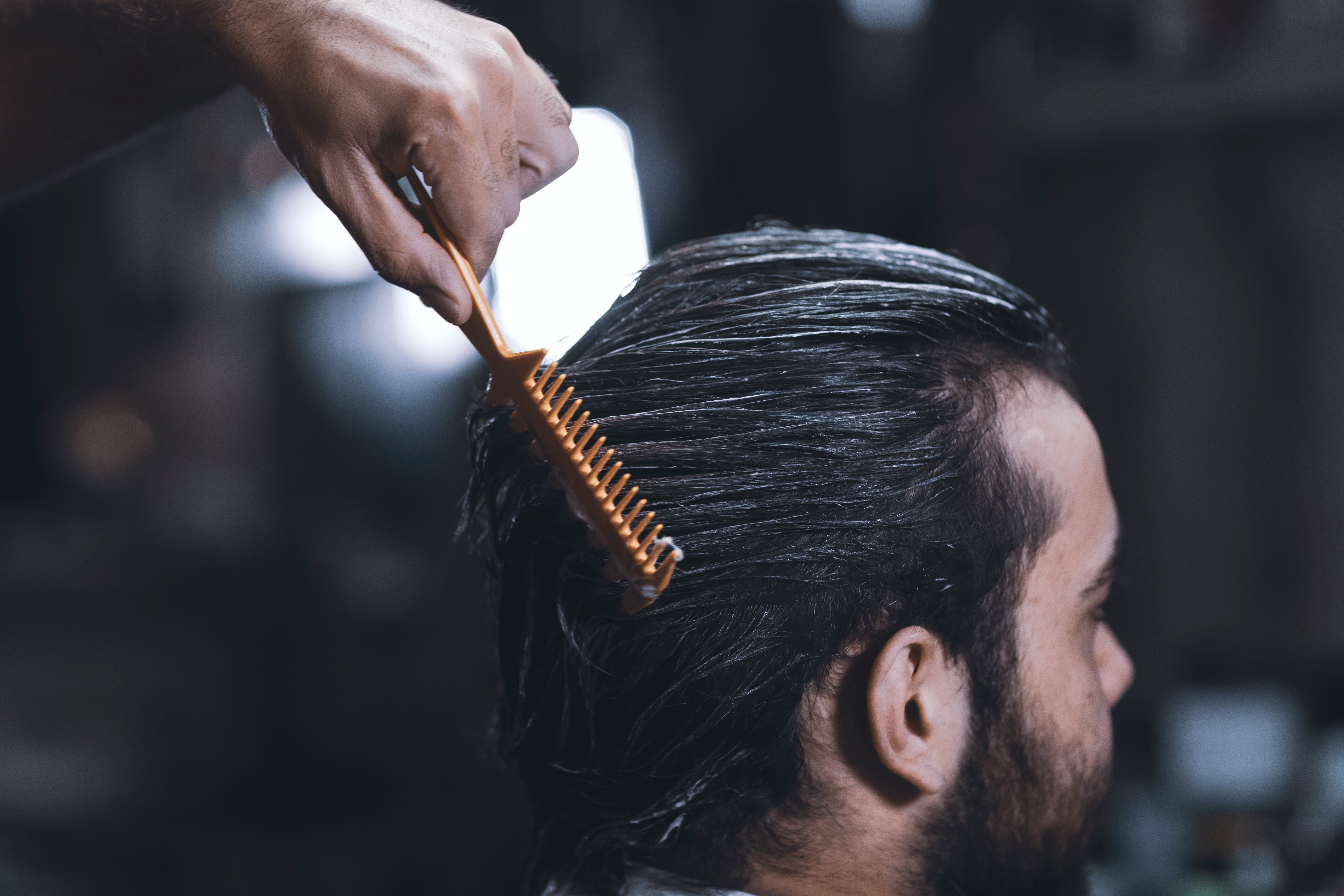 Hair Transplant can transform your life 