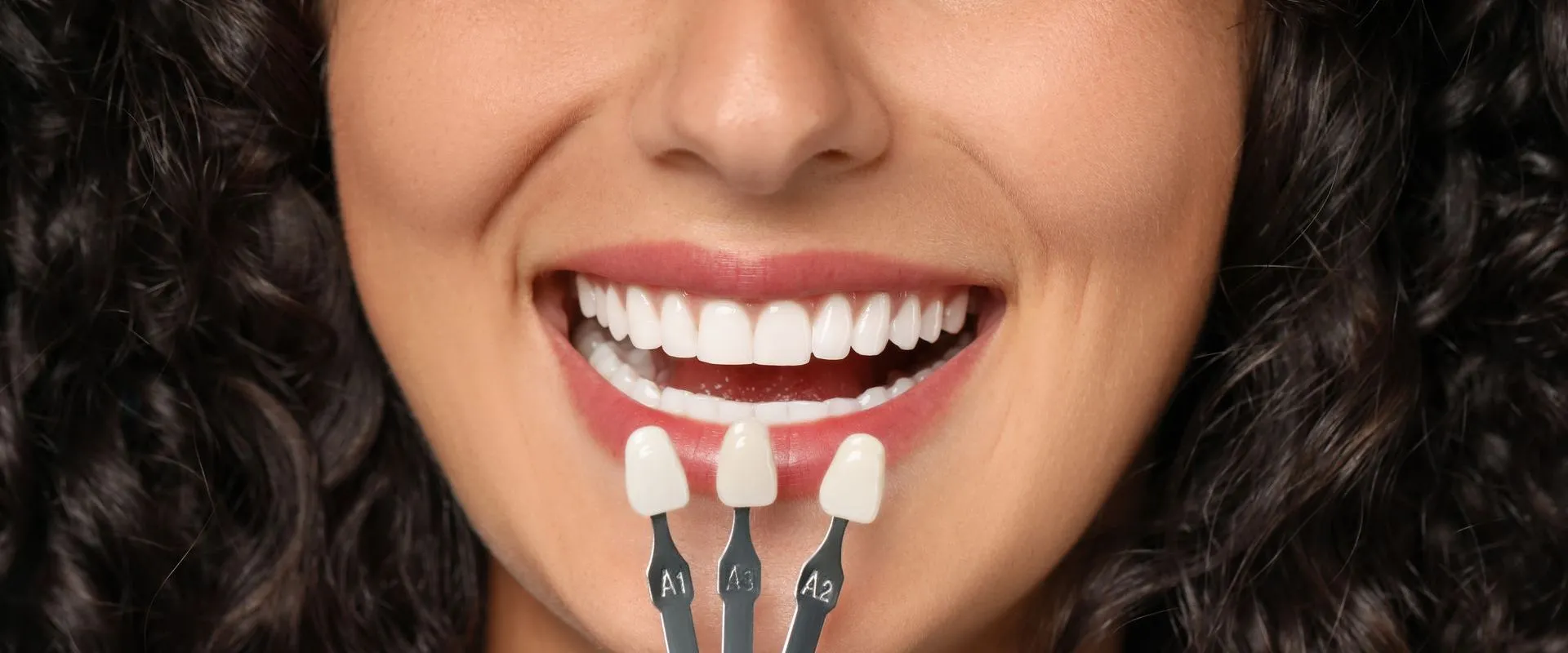 Facetas Dentárias, ou Lente no Dente
