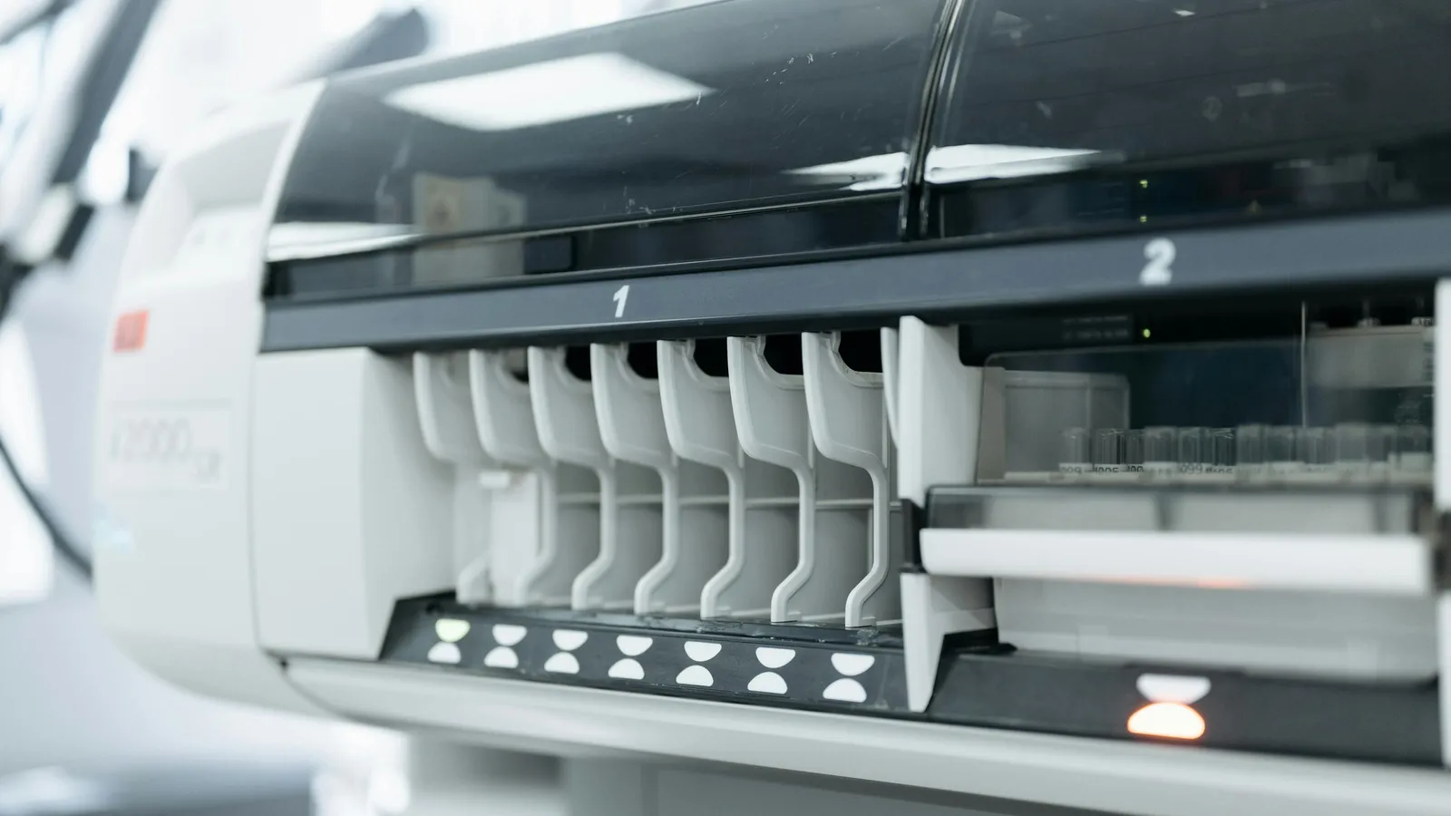 What Is the Normal MCV Range?