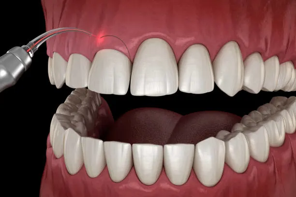 Intraoral Cameras