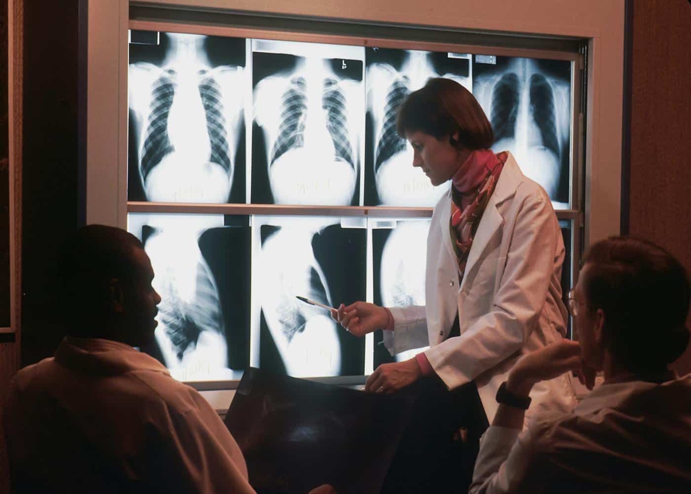 Doctors examining X-rays of a person's chest 