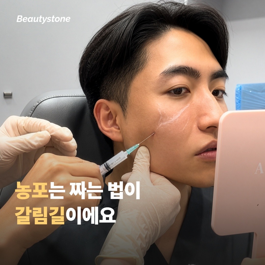 농포는 어떻게 짜느냐가 갈림길이에요