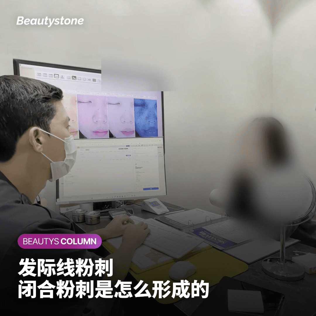 发际线处反复出现闭合粉刺，究竟是怎么回事
