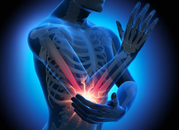 Physiotherapist providing sciatica pain relief treatment at Redux Movement Clinic in Mississauga.