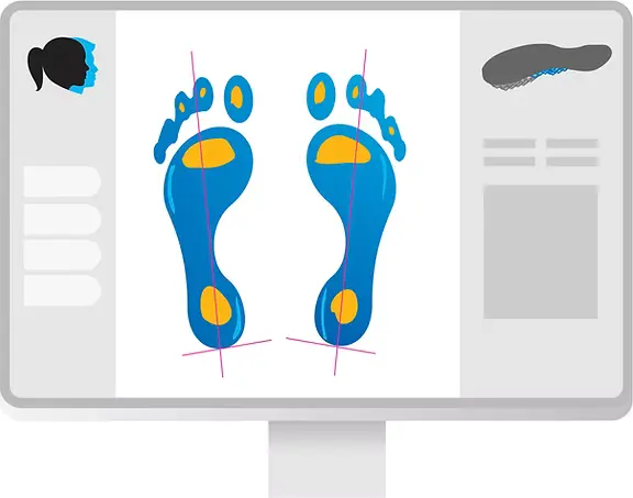 Computer screen showing Phits 3D custom insole design software, used to create orthotics for foot pain, plantar fasciitis, flat feet, high arches, and Morton's neuroma at Limitless Orthotics clinic, Leeds.