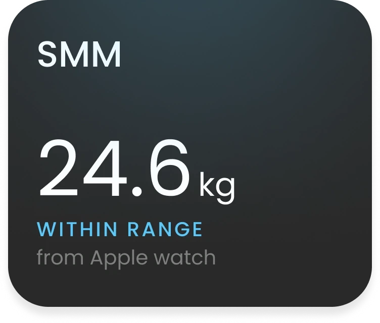 SMM