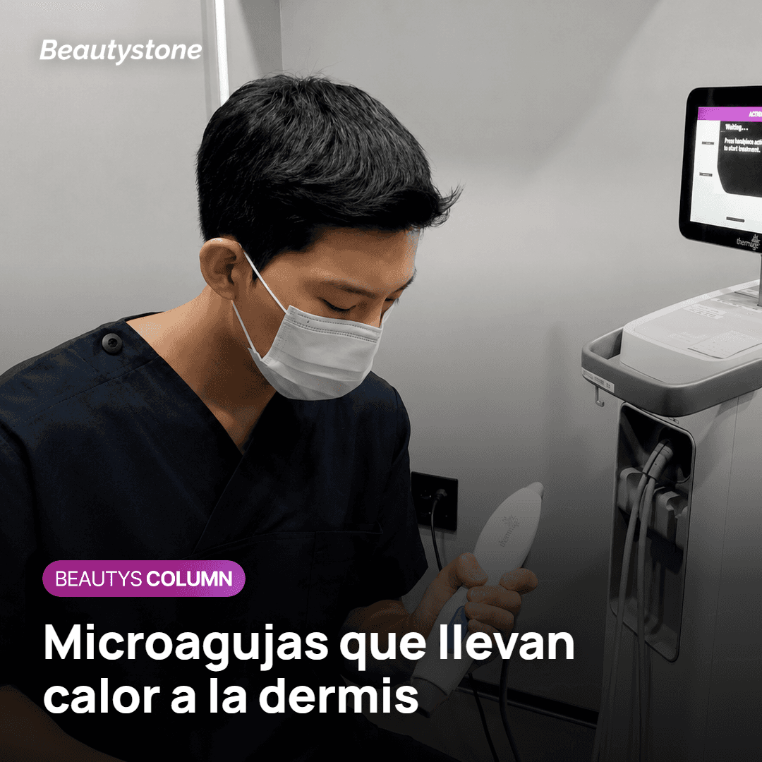 Potenza: microagujas que llevan calor de radiofrecuencia a la dermis