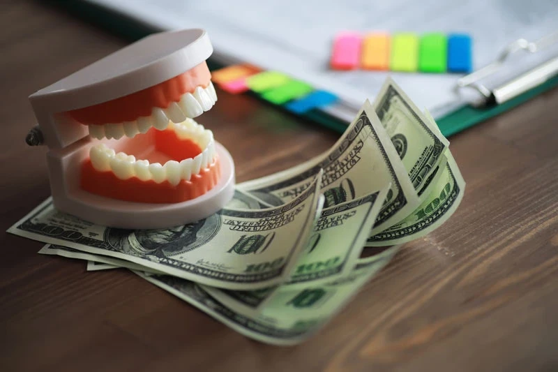 dental implants cost