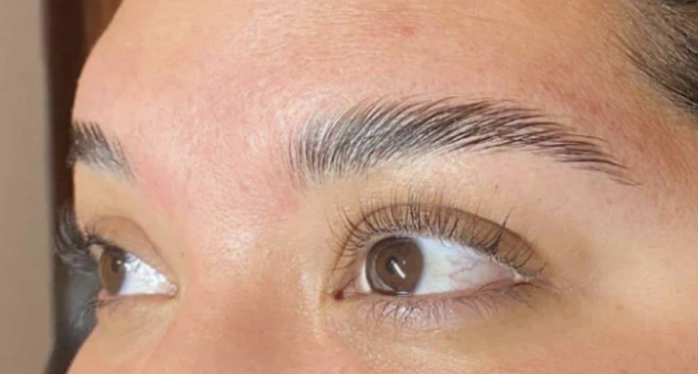 person's left eye