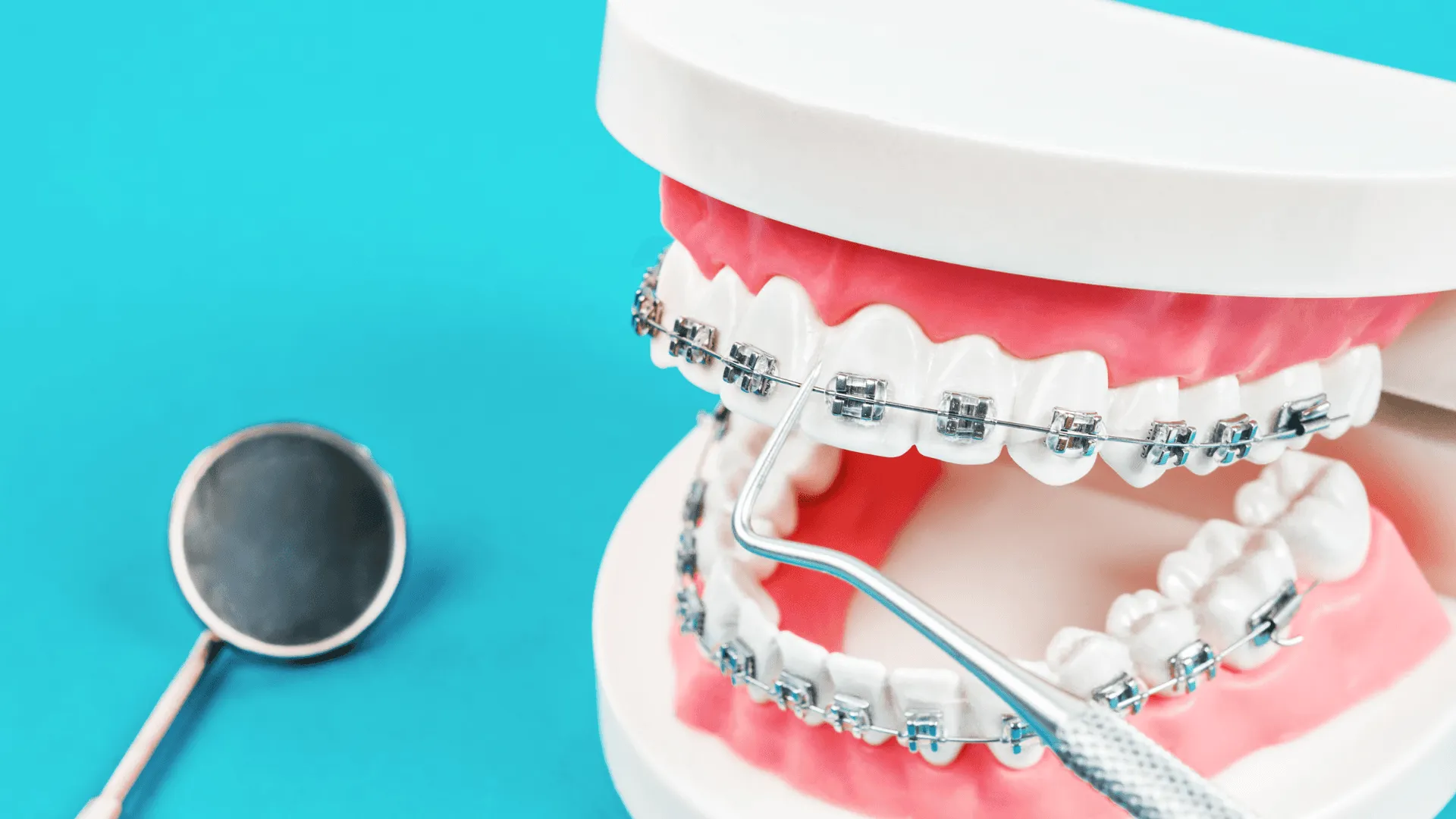 Braces for Adults at Midtown Orthodontics | Best Orthodontist in Midtown Toronto, ON