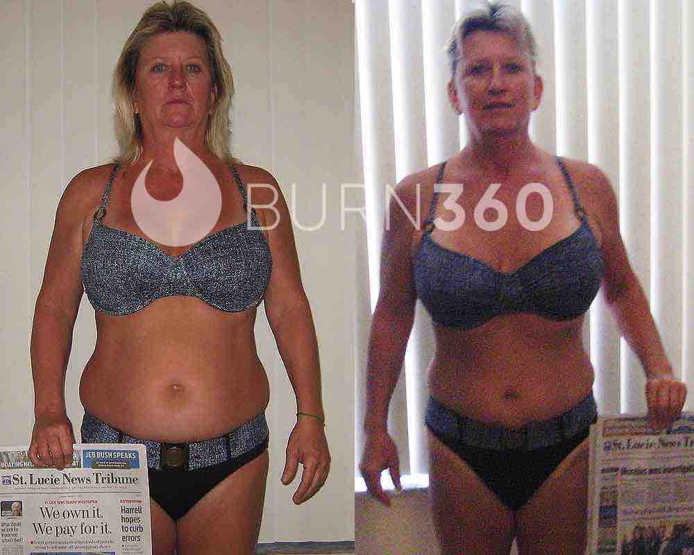 Mary's before and after photos (front)