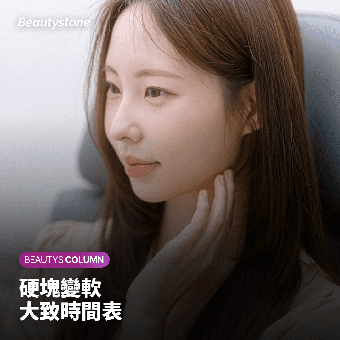 呈現 Sofwave 後硬塊逐漸變軟大致時間表的卡片