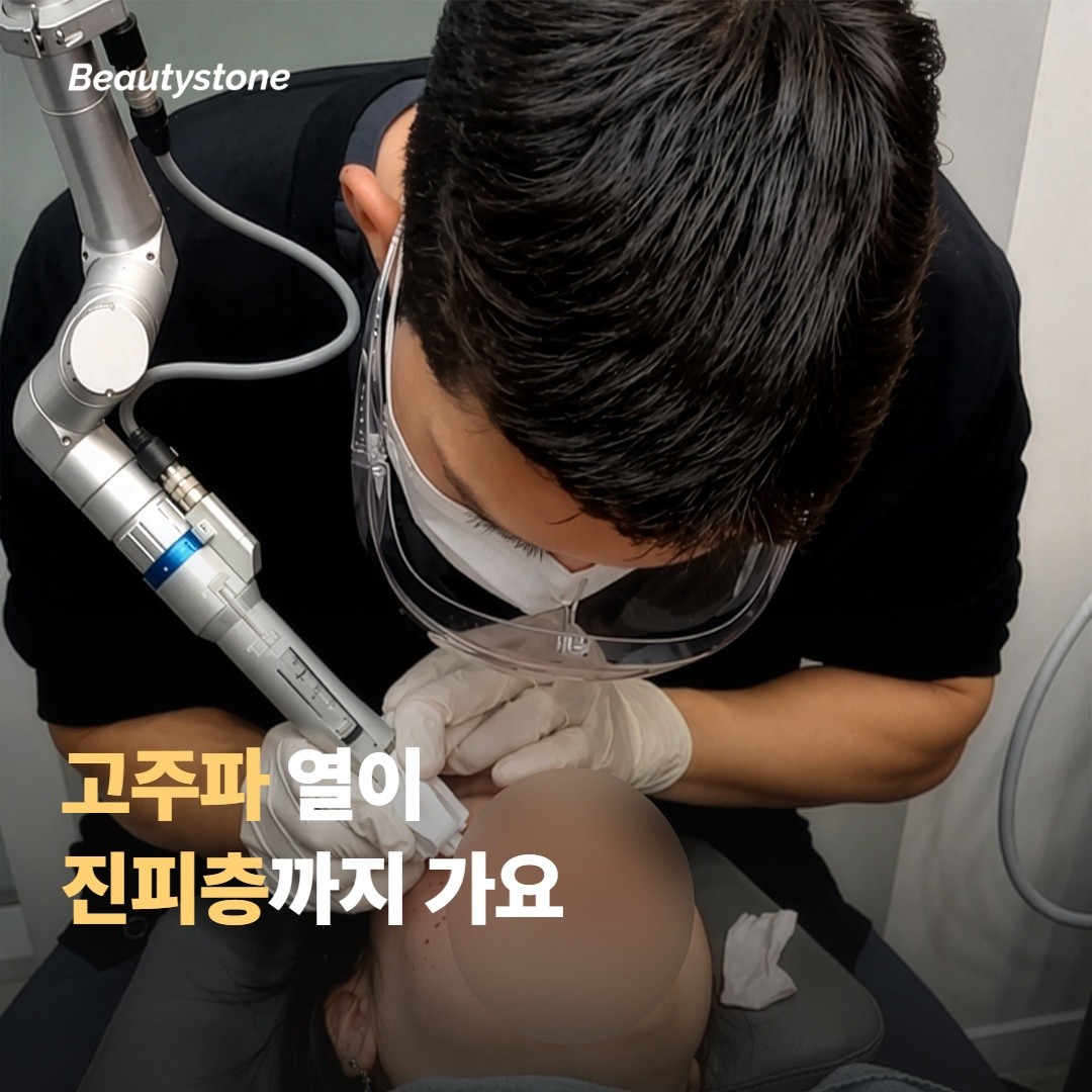 온다 리프팅은 어떻게 피부에 열을 전달하나요?