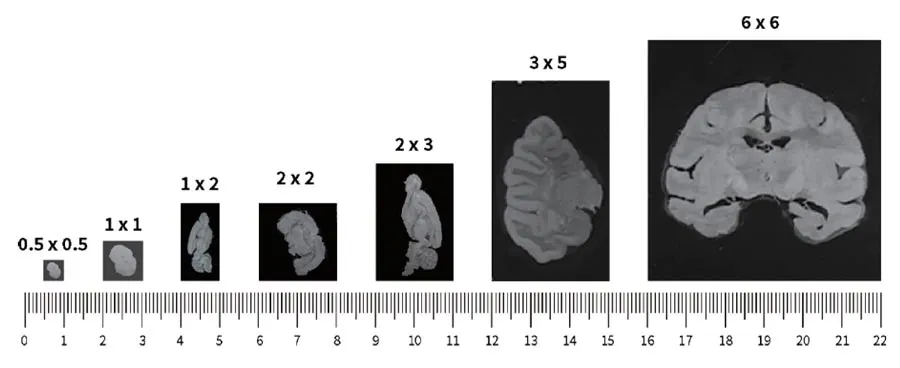 spatial-transcriptomics-varius-tissues-sizes