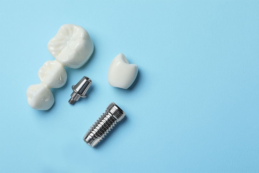 dental implants plainview