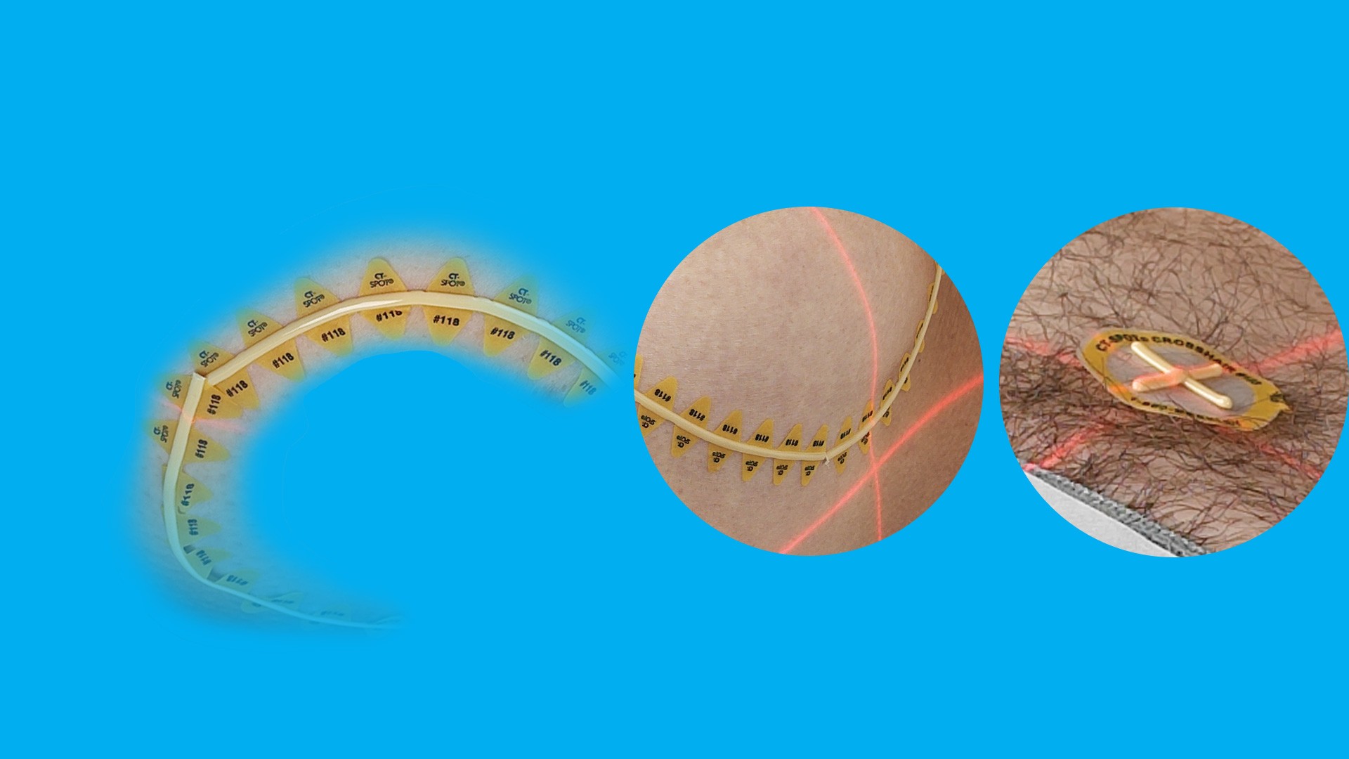CT Simulation Banner - CT-SPOT products