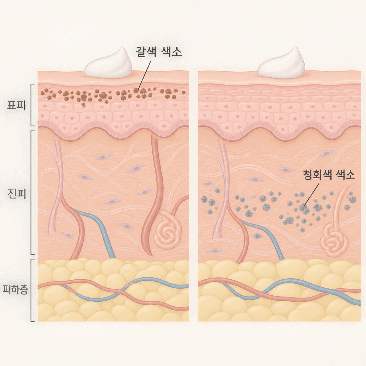 얕은 층의 갈색은 바르는 성분이 닿는 자리이고, 깊은 층의 청회색은 그보다 아래에 있어요