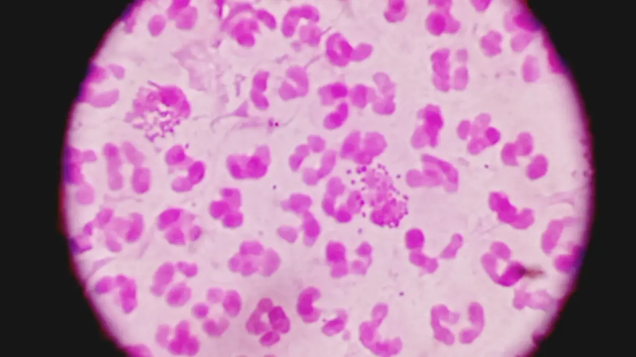 Exosome therapy in Vancouver