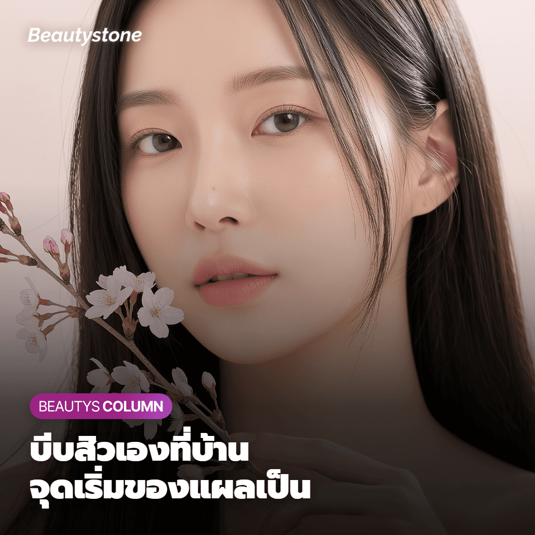 สิวที่บีบเองที่บ้านด้วยคัตตอนบัด จุดเปลี่ยนสำคัญที่ทำให้กลายเป็นแผลเป็นถาวร