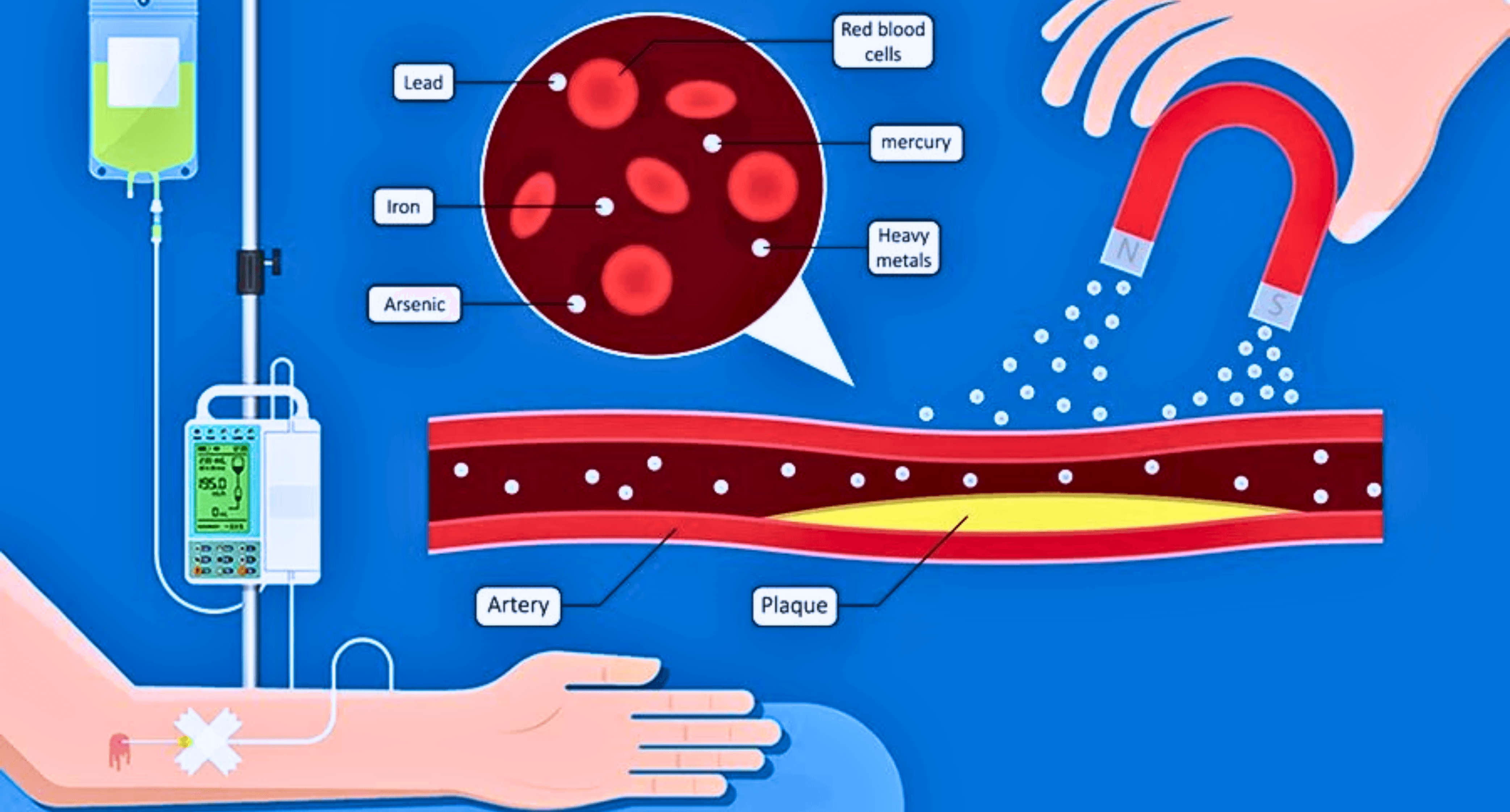 Chelation Therapy