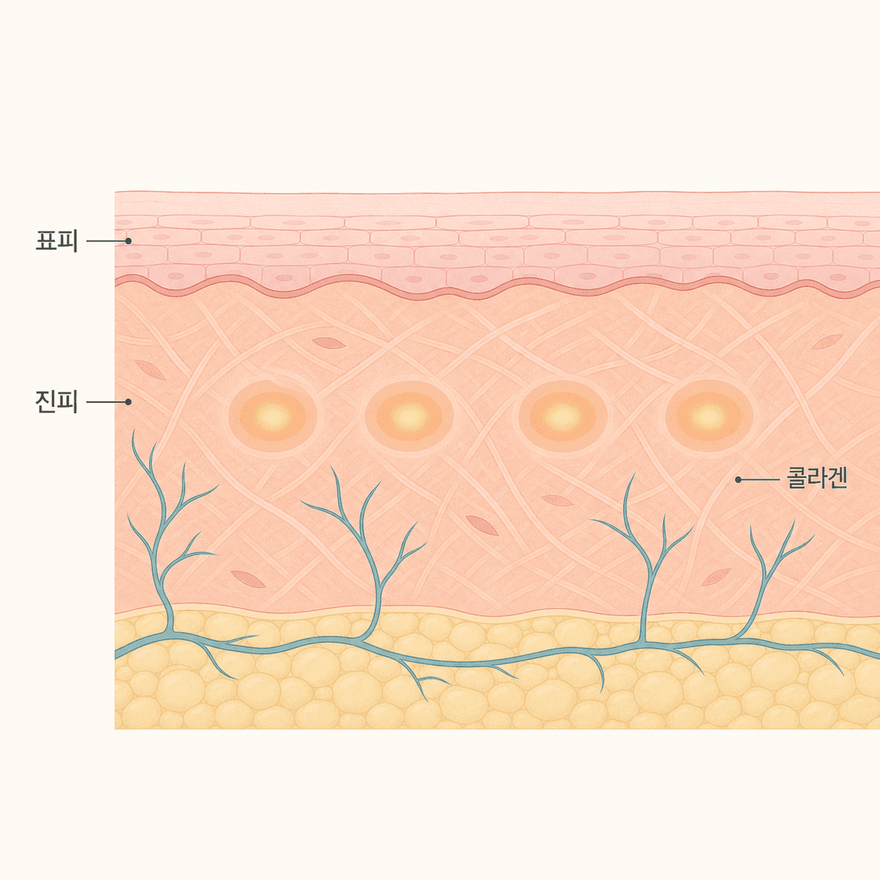 진피층에 전달된 초음파 에너지와 콜라겐 자극 구조