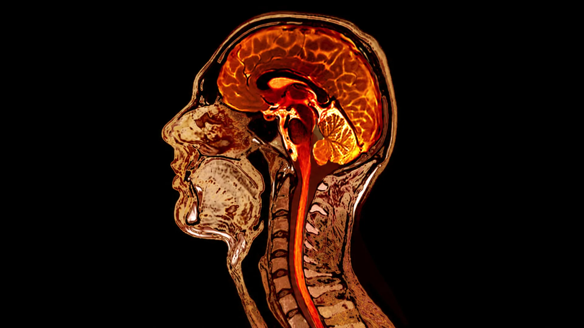 Cross-sectional diagnostic image of the head from a CT or MRI scan, showing key differences and use cases.