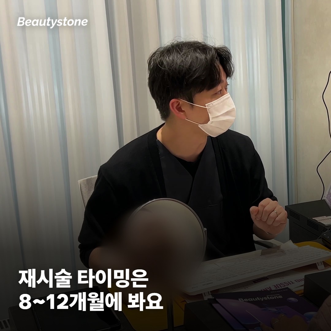 내 케이스는 얼마나 갈까, 재시술 타이밍
