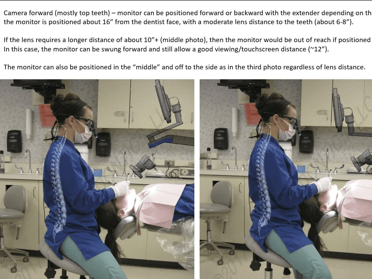 Ergonomic study of EZ Scope monitor positions with a dentist and patient