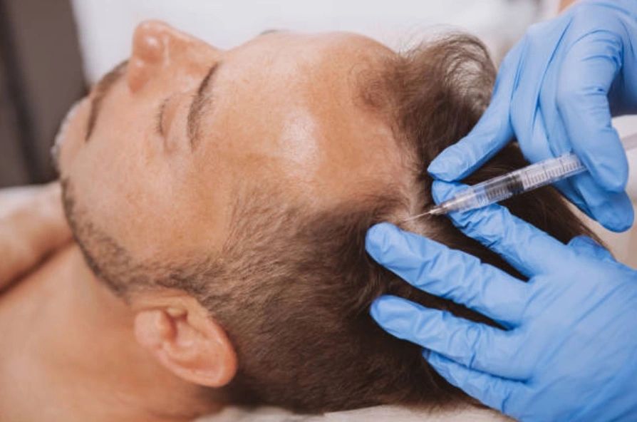 Platelet Rich Plasma (PRP) Injections